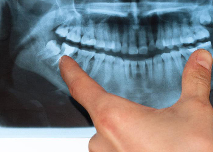 Smile Dental Clinic